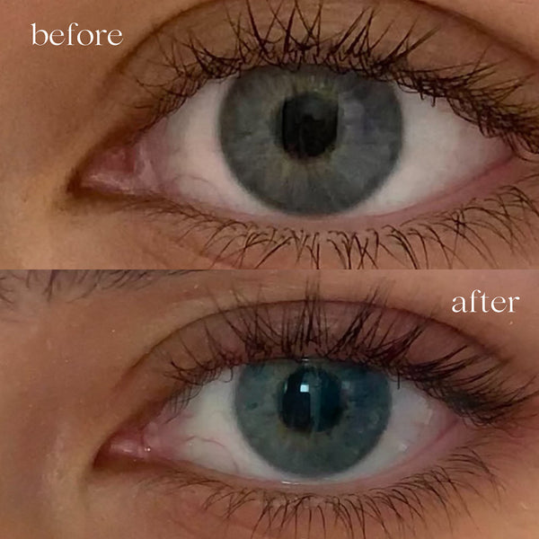 Before and after comparison of a blue eye with visible changes.