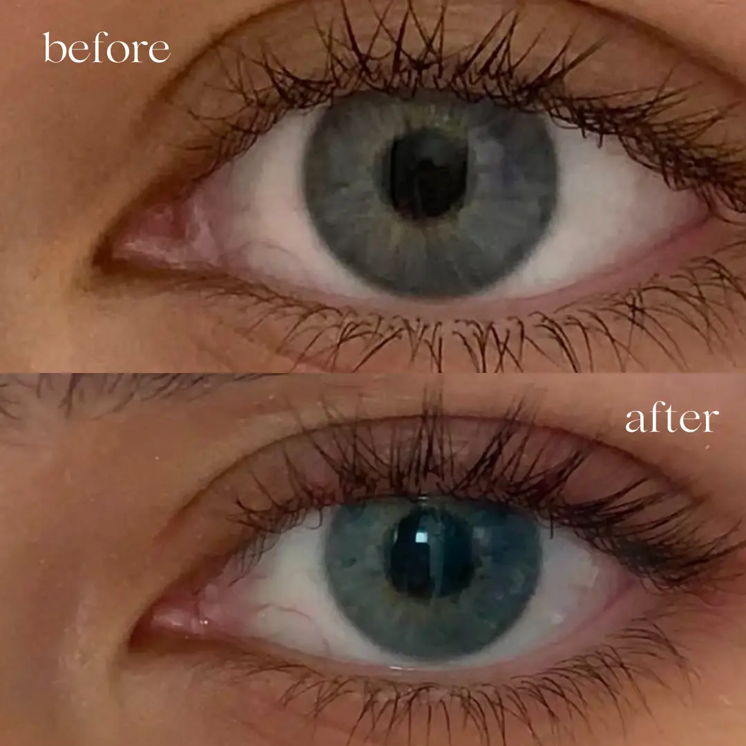 Before and after results using Llaria Beauty lash and brow growth serum